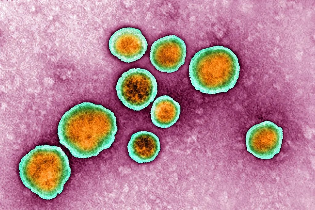 RSV in Germany: Essential Guide to Emerging Infection Wave