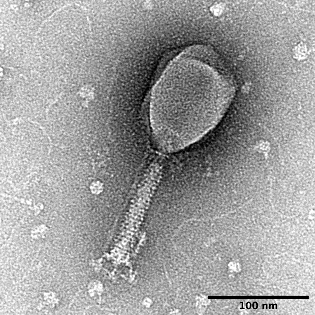 Transmission electron micrograph of a bacteriophage